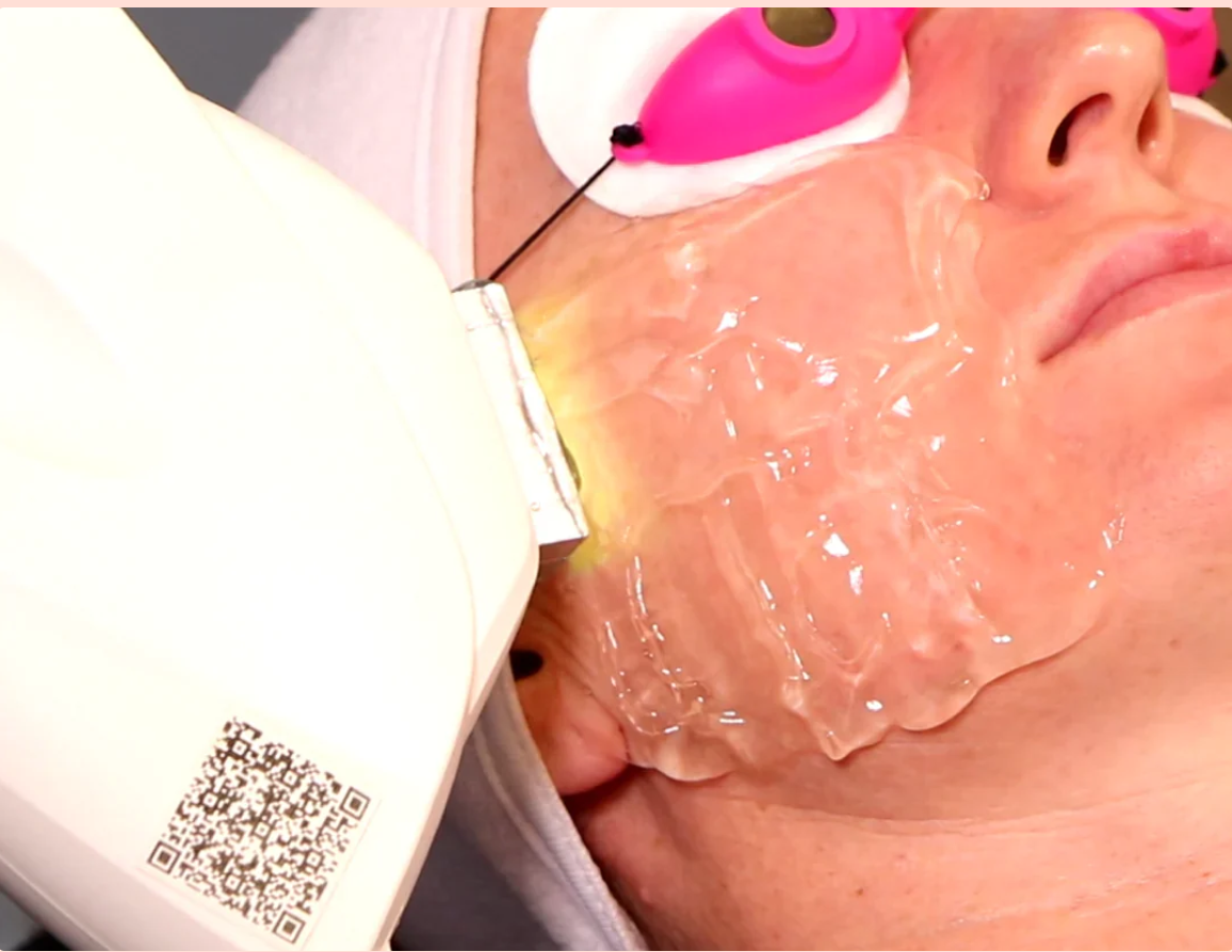 Things We’re Lovin’ Caci's Photo Rejuvenation