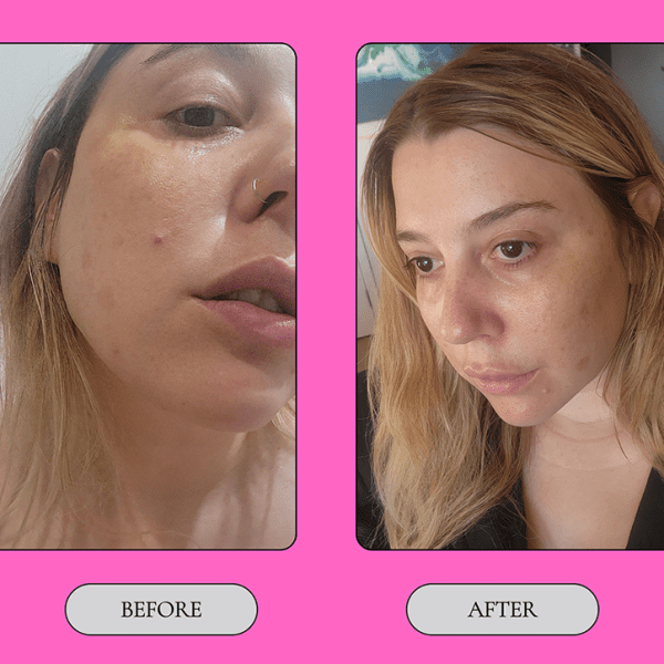 Things We’re Lovin: MEDIK8 Crystal Retinal Range